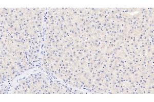 Detection of TDO in Human Liver Tissue using Monoclonal Antibody to Tryptophan-2,3-dioxygenase (TDO) (TDO2 antibody  (AA 1-406))