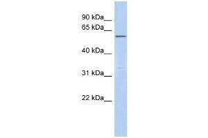 C6ORF182 antibody used at 1 ug/ml to detect target protein. (CEP57L1 antibody  (Middle Region))