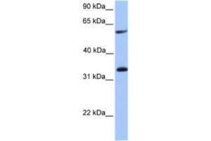 Western Blotting (WB) image for anti-Testis-Specific serine Kinase Substrate (TSKS) antibody (ABIN2463605) (TSKS antibody)