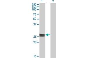 Western Blot analysis of TK1 expression in transfected 293T cell line by TK1 monoclonal antibody (M05), clone 3F9. (TK1 antibody  (AA 1-234))