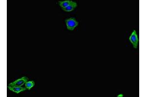 Immunofluorescent analysis of HepG2 cells using ABIN7153773 at dilution of 1:100 and Alexa Fluor 488-congugated AffiniPure Goat Anti-Rabbit IgG(H+L) (GMIP antibody  (AA 719-858))