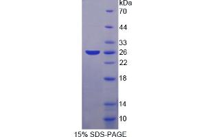 Image no. 1 for S-Phase Kinase-Associated Protein 1 (SKP1) (AA 1-163) protein (His tag) (ABIN6237470)