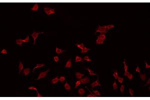 ABIN6272303 staining MDA-MB-435 by IF/ICC. (PMP22 antibody  (C-Term))