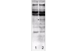 Affinity Purified antibody to Caspase-2  was used at a 1:750 dilution to detect rat caspase-2 in transfected human 292 cell lysates by Western blot. (Caspase 2 antibody  (N-Term))