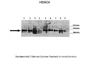 Lanes:   Lane 1: 40ug mouse brain, synaptosome lysate  Lane 2: 40ug mouse brain, membrane fraction  Lane 3: 40ug mouse brain, cytoplasm fraction  Lane 4: 40ug mouse brain, nuclear fraction  Lane 5: 40ug mouse brain, post synaptic density fraction  Lane 6: 40ug mouse brain, synaptosome lysate  Lane 7: 40ug mouse brain, membrane fraction  Lane 8: 40ug mouse brain, cytoplasm fraction  Lane 9: 40ug mouse brain, nuclear fraction   Primary Antibody Dilution:   1:1000  Secondary Antibody:   Goat anti-rabbit HRP  Secondary Antibody Dilution:   1:2000  Gene Name:   Hdac4  Submitted by:   Wen-Cheng Xiong, Georgia Health Sciences University (HDAC4 antibody  (C-Term))