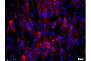 Human endothelial cells labeled with Rabbit Anti-Biglycan Polyclonal Antibody, Unconjugated  was used to stain the cell nuclei (Biglycan antibody  (AA 101-200))