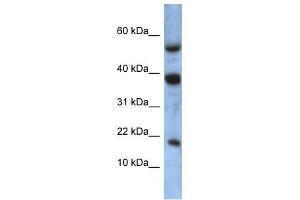 ATXN7L1 antibody used at 1 ug/ml to detect target protein. (ATXN7L1 antibody  (Middle Region))