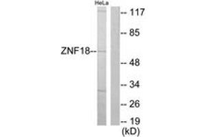 Western blot analysis of extracts from HeLa cells, using ZNF18 Antibody. (ZNF18 antibody  (AA 261-310))