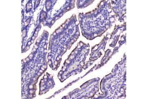 IHC analysis of Cannabinoid Receptor I using anti-Cannabinoid Receptor I antibody . (CNR1 antibody  (AA 1-75))