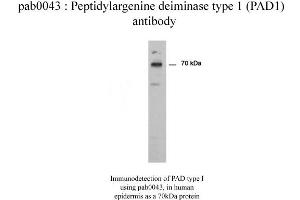 Image no. 2 for anti-Peptidyl Arginine Deiminase, Type I (PADI1) antibody (ABIN346990) (PADI1 antibody)