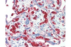 Anti-Erythrocytes antibody IHC staining of human placenta. (Erythrocytes antibody)