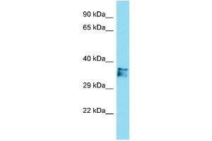 Host: Rabbit Target Name: C14orf79 Sample Type: Jurkat Whole Cell lysates Antibody Dilution: 1. (C14ORF79 antibody  (N-Term))