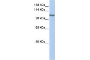 Image no. 1 for anti-Trimethylguanosine Synthase 1 (TGS1) (AA 432-481) antibody (ABIN6743501) (TGS1 antibody  (AA 432-481))