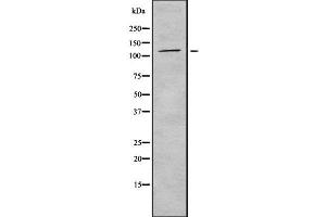 Western blot analysis of ICAM3 using HepG2 whole  lysates. (ICAM-3/CD50 antibody  (Internal Region))