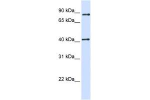 WB Suggested Anti-TXNDC13 Antibody Titration:  0. (TMX4 antibody  (C-Term))