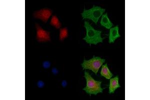 ABIN6257435 and ABIN6275362 staining HepG2 cells by IF/ICC.