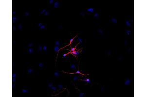 Immunofluorescence staining of P-19 mouse embryonal carcinoma cell line stimulated to neuronal differentiation by retinoic acid. (TUBB3 antibody  (N-Term))