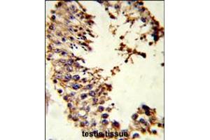 Formalin-fixed and paraffin-embedded human testis tissue reacted with ACR Antibody , which was peroxidase-conjugated to the secondary antibody, followed by DAB staining. (Achaete-scute complex protein T5 (AC) (AA 99-127) antibody)
