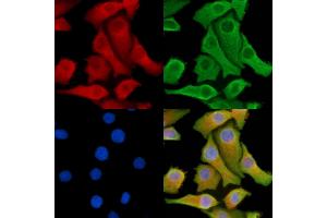 ABIN7095288 and ABIN7099345 staining Hela cells by IF/ICC. (SOCS5 antibody)