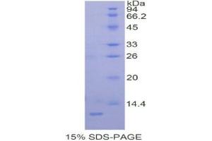 SDS-PAGE (SDS) image for Preferentially Expressed Antigen in Melanoma (PRAME) (AA 416-502) protein (His tag) (ABIN2121931) (PRAME Protein (AA 416-502) (His tag))