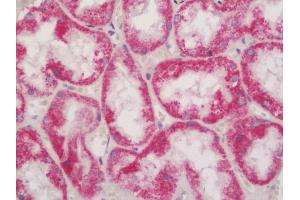 Human Kidney: Formalin-Fixed, Paraffin-Embedded (FFPE) (MAPK8IP1 antibody  (AA 470-498))