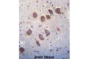 Immunohistochemistry (IHC) image for anti-Diacylglycerol Kinase, theta 110kDa (DGKQ) antibody (ABIN3003694) (DGKQ antibody)