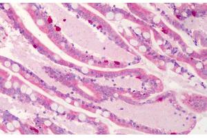 Human Small Intestine: Formalin-Fixed, Paraffin-Embedded (FFPE) (C1QTNF4 antibody  (C-Term))