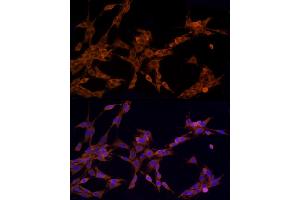 Immunofluorescence (IF) image for anti-Nucleotide-Binding Oligomerization Domain Containing 2 (NOD2) (AA 611-910) antibody (ABIN7269065)