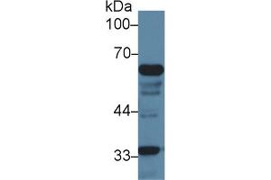 Detection of IkBz in Mouse Liver lysate using Polyclonal Antibody to Inhibitory Subunit Of NF Kappa B Zeta (IkBz) (Inhibitory Subunit of NF-KappaB zeta (AA 414-654) antibody)