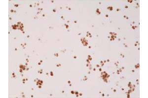 Immunocytochemistry (ICC) image for anti-Androgen Receptor (AR) (N-Term) antibody (ABIN4953295)