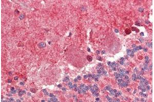 Brain, cerebellum, Human: Formalin-Fixed, Paraffin-Embedded (FFPE) (FABP7 antibody  (AA 101-111))