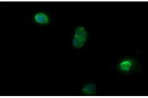 Image no. 3 for anti-NADPH Dependent Diflavin Oxidoreductase 1 (NDOR1) antibody (ABIN1499655) (NDOR1 antibody)
