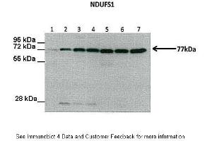 Lanes:  Lane1: 30 ug Human liver Lane2: 30 ug Rat liver Lane3: 30 ug Mouse (wild-type) liver Lane4: 30 ug Mouse [AMPK alpha 1/2(-/-)] liver Lane5: 30 ug Human muscle Lane6: 30 ug Rat muscle Lane7: 30 ug Mouse muscle Primary Antibody Dilution:  1:1000 Secondary Antibody:   Secondary Antibody Dilution:  1:10000 Gene Name:  NDUFS1 Submitted by:  Dr. (NDUFS1 antibody  (Middle Region))