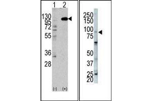 (LEFT) Western blot analysis of anti-hFGFR2-C808 Pab in 293 cell line lysates transiently transfected with the FGFR2 gene (2ug/lane). (FGFR2 antibody  (C-Term))