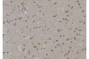 ABIN6269295 at 1/100 staining Human brain tissue by IHC-P. (14-3-3 zeta antibody  (Internal Region))