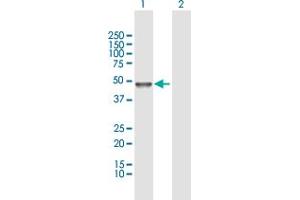 Western Blot analysis of TUBAL3 expression in transfected 293T cell line by TUBAL3 MaxPab polyclonal antibody. (TUBAL3 antibody  (AA 1-406))
