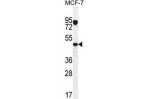 VEGF3 Antibody (N-term) western blot analysis in MCF-7 cell line lysates (35 µg/lane). (VEGFC antibody  (N-Term))