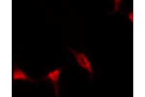 ABIN6267464 staining HeLa by IF/ICC. (CDC25A antibody  (pSer178))