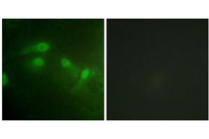 Immunofluorescence analysis of HeLa cells, using MDM2 (Phospho-Ser186+Ser188) antibody. (MDM2 antibody  (pSer186, pSer188))