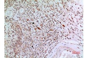 Immunohistochemistry (IHC) analysis of paraffin-embedded Human Brain, antibody was diluted at 1:100. (CD3D antibody  (Internal Region))