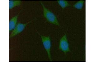 ICC/IF analysis of PMVK in PC3 cells line, stained with DAPI (Blue) for nucleus staining and monoclonal anti-human PMVK antibody (1:100) with goat anti-mouse IgG-Alexa fluor 488 conjugate (Green). (PMVK antibody  (AA 1-192))
