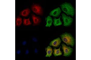 ABIN6256390 and ABIN6267486 staining Hela cells(4h of LPS treatment) by IF/ICC.