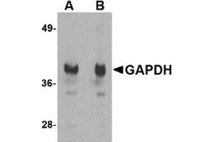 Western Blotting (WB) image for anti-Glyceraldehyde-3-Phosphate Dehydrogenase (GAPDH) (N-Term) antibody (ABIN1031392) (GAPDH antibody  (N-Term))