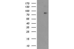 HEK293T cells were transfected with the pCMV6-ENTRY control (Left lane) or pCMV6-ENTRY NFKBIZ (Right lane) cDNA for 48 hrs and lysed. (NFKBIZ antibody)