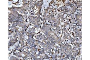 IHC analysis of Cathepsin B/CTSB using anti-Cathepsin B/CTSB antibody (ABIN7601692). (Cathepsin B antibody  (AA 42-339))