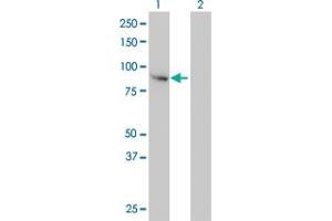 Western Blot analysis of FES expression in transfected 293T cell line by FES monoclonal antibody (M01), clone 3A3-1E5. (FES antibody  (AA 1-822))