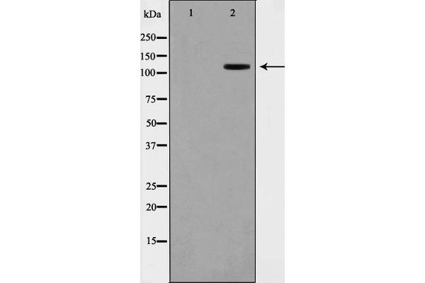 XRN2 antibody