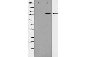 Western blot analysis on COS7 cell lysate using XRN2 Antibody,The lane on the left is treated with the antigen-specific peptide.