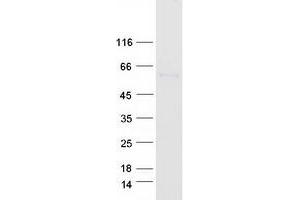 Validation with Western Blot (E2F1 Protein (Myc-DYKDDDDK Tag))