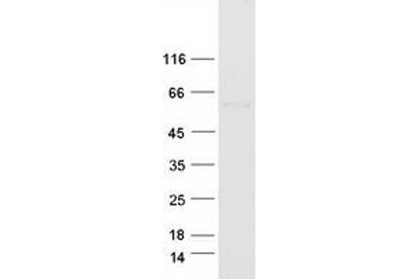 E2F1 Protein (Myc-DYKDDDDK Tag)